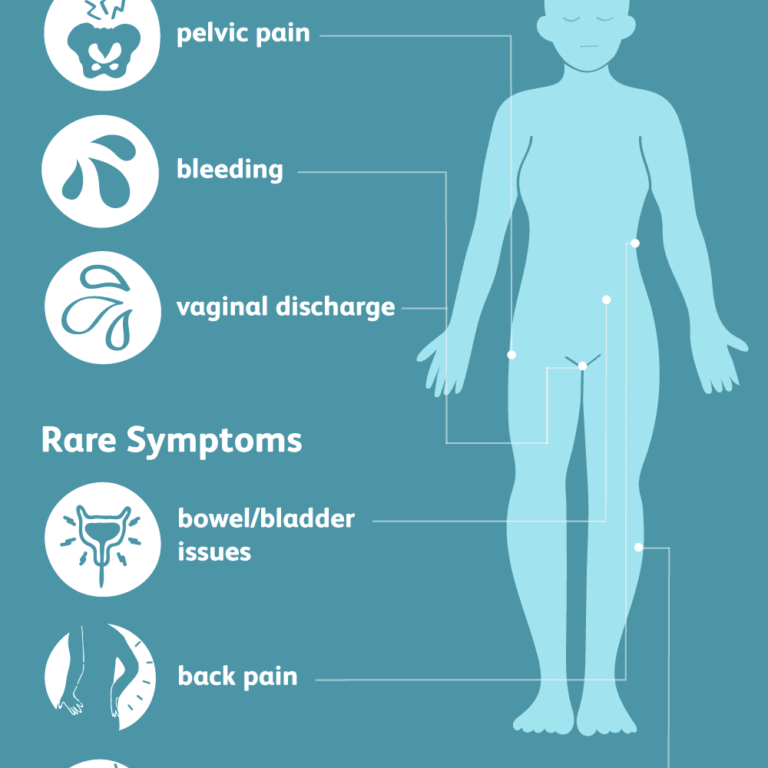 Cervical Cancer: Its Symptoms And Signs – AboveTheOrangeTrees.com